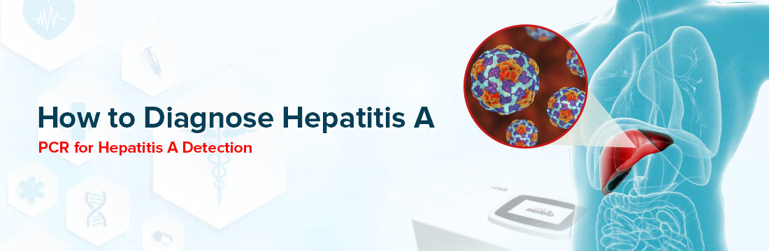  How to Diagnose Hepatitis A? PCR for Hepatitis A Detection